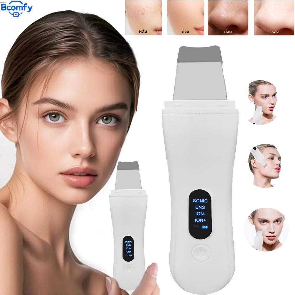 Professional Ultrasonic Skin Scrubber – Deep Pore Cleanser